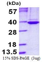 Human TBCB / CKAP1 Protein (Recombinant His)