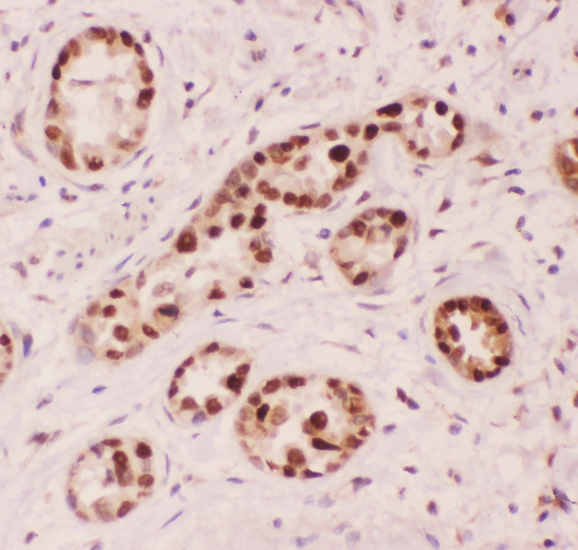 APEX1 / APE1 Antibody (aa2-318)