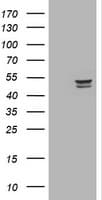 TP / Thymidine Phosphorylase Antibody (clone OTI1G10)