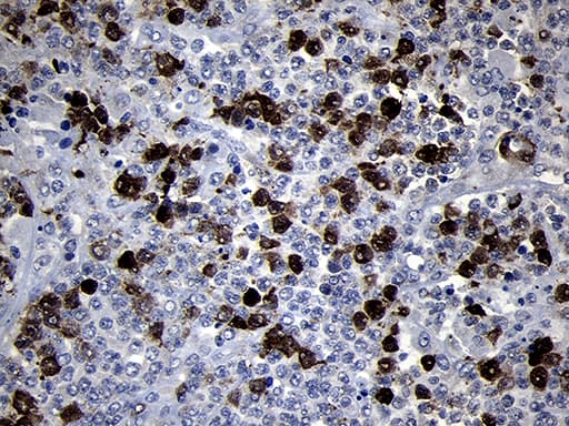 Monoclonal Mouse anti-Human RRM2 Antibody (clone OTI1F2, IHC, WB)