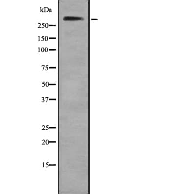 Polyclonal Rabbit anti-Human COL7A1 / Collagen VII Antibody (aa2862-2888, WB)