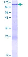 Human NOC2L Protein (Recombinant GST)