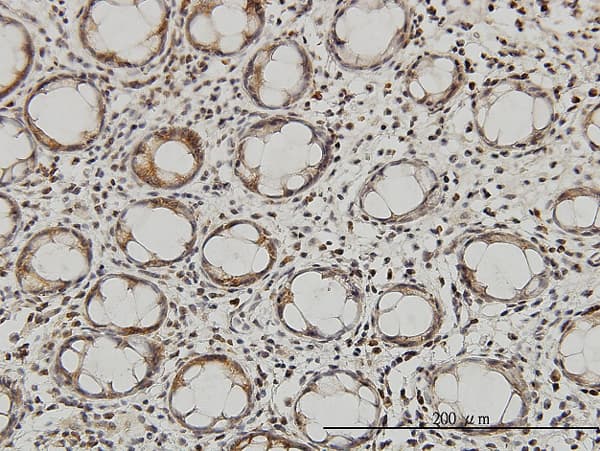 GLNRS / QARS Antibody (clone 5F5)