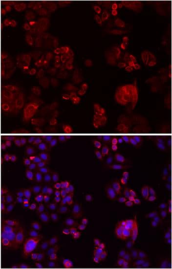 IHC-plus™ Polyclonal Rabbit anti-Human NOTCH3 Antibody (IHC, IF, WB)