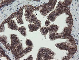 FAM164A / CGI-62 Antibody (clone OTI4C1)