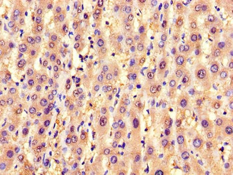 Polyclonal Rabbit anti-Human SLC25A6 / ANT3 Antibody (IHC, WB)