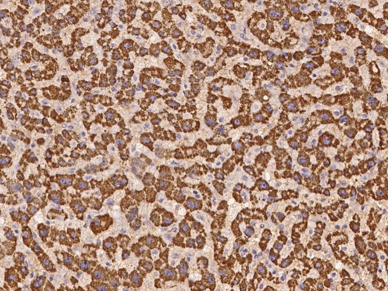 Polyclonal Rabbit anti-Human WSCD2 Antibody (IHC)