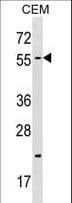 Polyclonal Rabbit anti-Human CBX4 Antibody (aa1-30, WB)