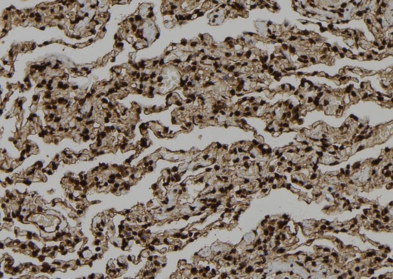 Polyclonal Rabbit anti-Human SMYD3 Antibody (IHC, IF, WB)