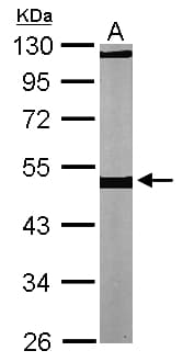 PathPlus™ TUBB / Beta Tubulin Antibody (aa174-428)