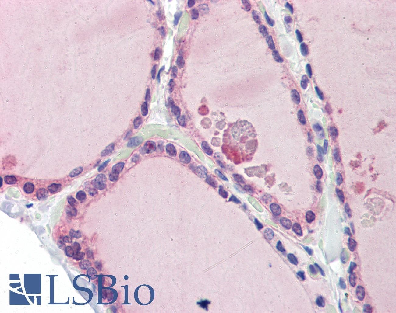 LDOC1 Antibody (N-Terminus)