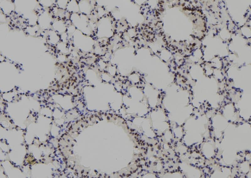 Polyclonal Rabbit anti-Human PKP3 / Plakophilin 3 Antibody (IHC, WB)