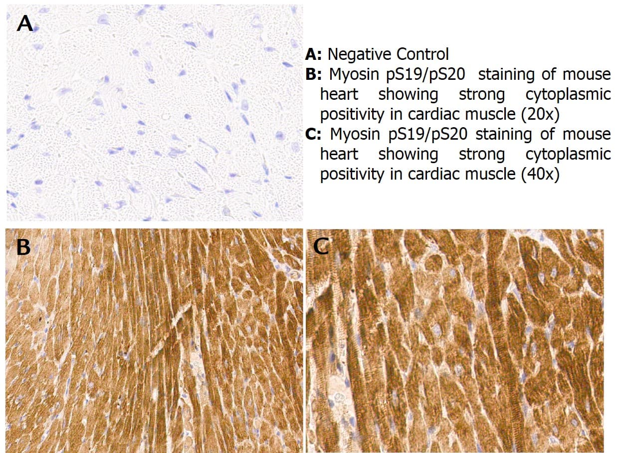 Polyclonal Rabbit anti-Human MYL12A / MRCL3 Antibody (phospho-Ser19/20, IHC, WB)