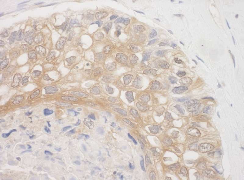 IHC-plus™ BAG3 / BAG-3 Antibody (aa525-575)