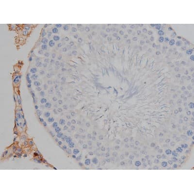 MAPT / Tau Antibody (phospho-Ser422)