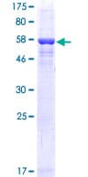 Human RLBP1 / CRALBP Protein (Recombinant GST)