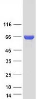 Human SPDL1 / CCDC99 Protein (Recombinant Myc-DDK (Flag))