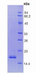 Human F8 / FVIII / Factor VIII Protein (Recombinant His, N-Terminal)
