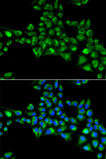 Polyclonal Rabbit anti-Human CYGB / Cytoglobin Antibody (IF, WB)
