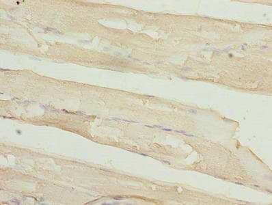 Polyclonal Rabbit anti-Human TIMP1 Antibody (IHC, WB)