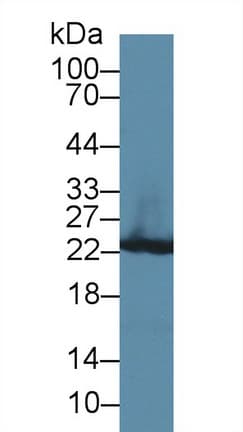 GSTP1 / GST Pi Antibody (aa1-210, PE)