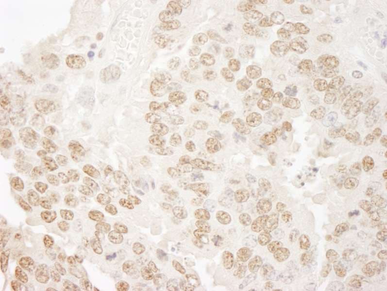 PRPF3 Antibody (aa100-150)