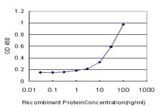 IHC-plus™ Vitamin D Receptor / VDR Antibody (clone 2F4)