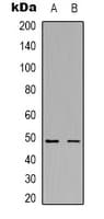 FN1 / Fibronectin Antibody