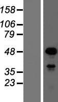 SOX18 Protein (Over-Expression Lysate Myc-DDK (Flag))