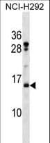 HIST2H2BF Antibody (aa14-42)