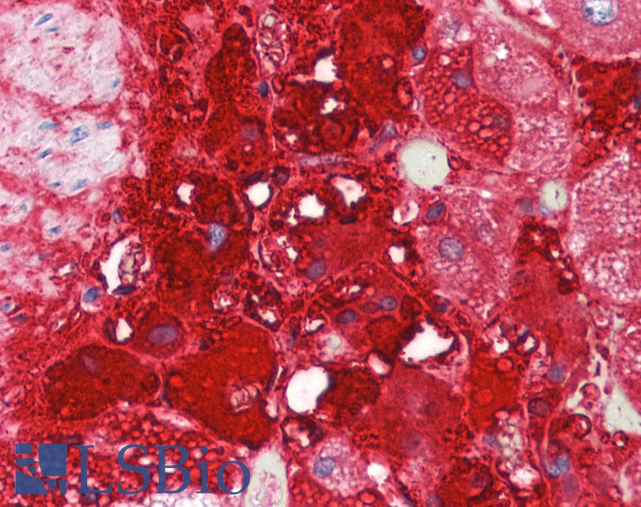 PathPlus™ Polyclonal Rabbit anti-Rat TH / Tyrosine Hydroxylase Antibody (IHC, IF, WB)