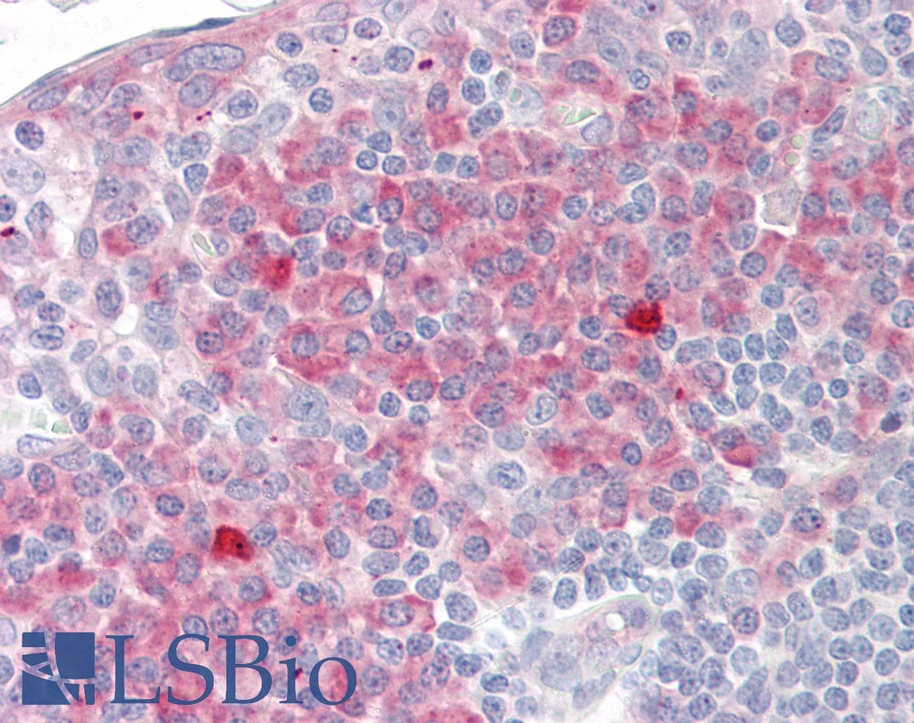 IHC-plus™ TPT1 / TCTP Antibody (aa71-120)