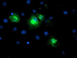 LPAR1 / LPA1 / EDG2 Antibody (clone OTI1G6)