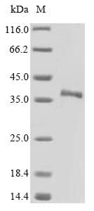 Mouse SFRP5 Protein (Recombinant 6His, N-terminus)