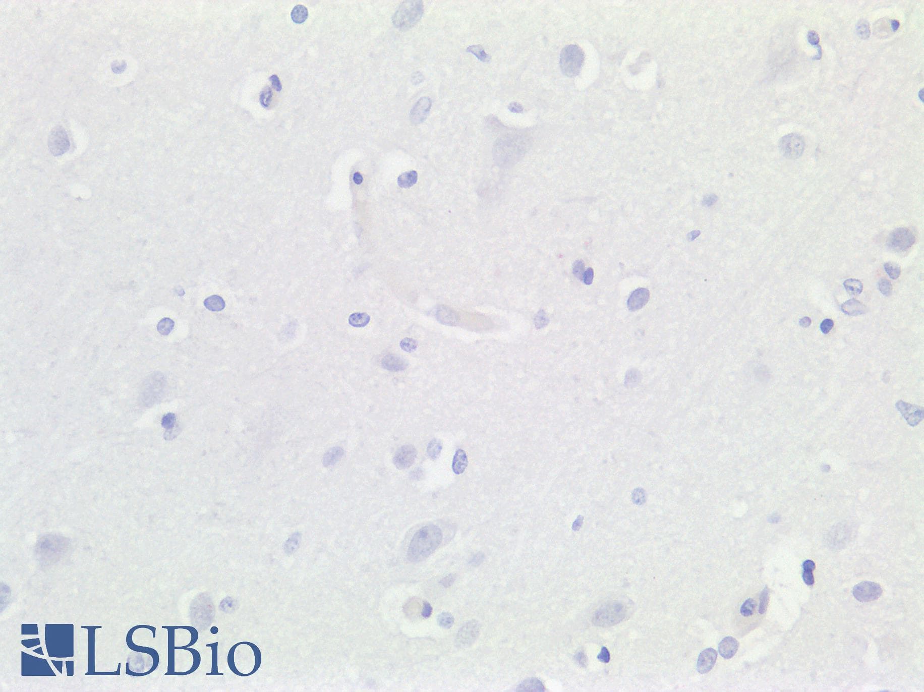 HAPLN1 Antibody (aa35-84)