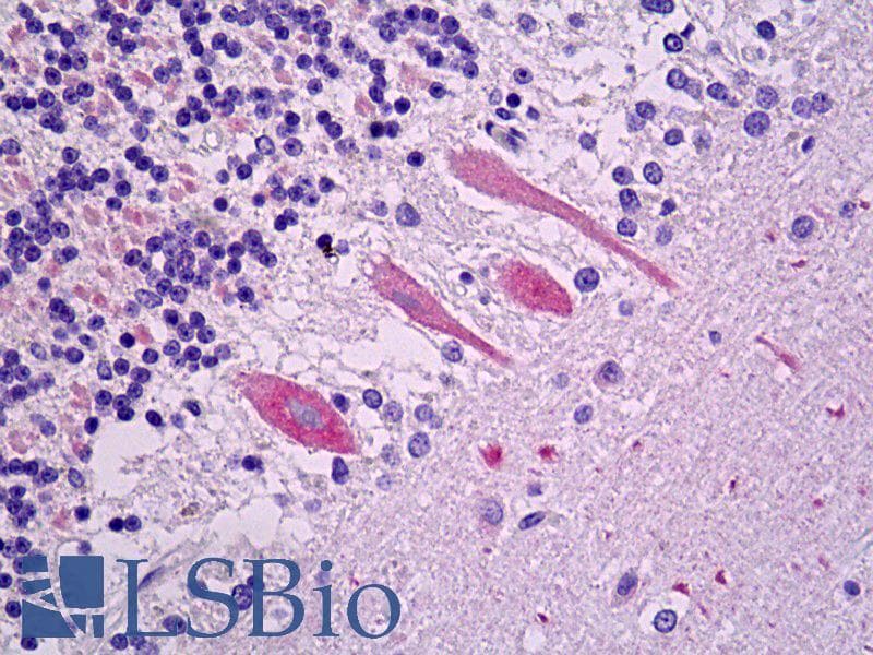 VLDLR Antibody (clone 1H10)