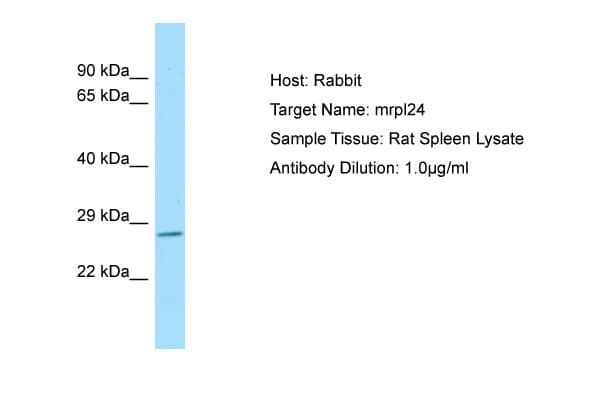 MRPL24 Antibody (C-Terminus)