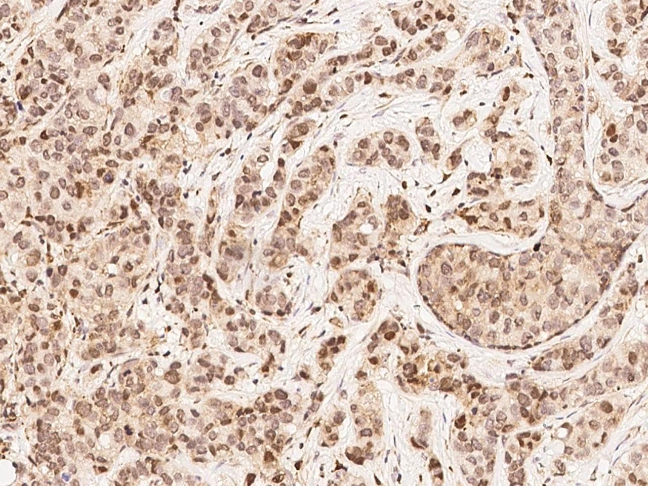 Polyclonal Rabbit anti-Human MAP2K4 / MKK4 Antibody (Preservative Free, IHC, IF)
