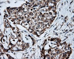 PTPRE / PTP Epsilon Antibody (clone OTI5F2)