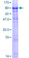 Human HABP2 Protein (Recombinant GST)