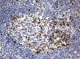Monoclonal Mouse anti-Human MKI67 / Ki67 Antibody (clone OTI5D7, IHC)