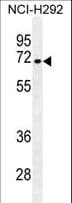 NUMB Antibody (aa1-30)