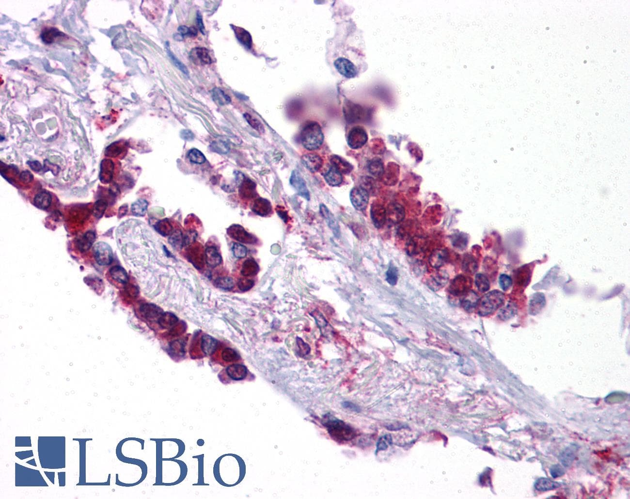KLF2 Antibody (aa216-265)