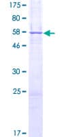 Human CYB5R1 Protein (Recombinant GST)
