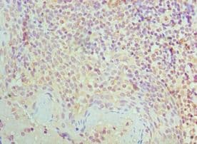 SMC1A / SMC1 Antibody (aa1-130)