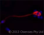 LL37 / Cathelicidin Antibody (clone OSX12)