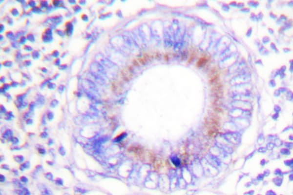 PTPN6 / SHP1 Antibody (Lys530)