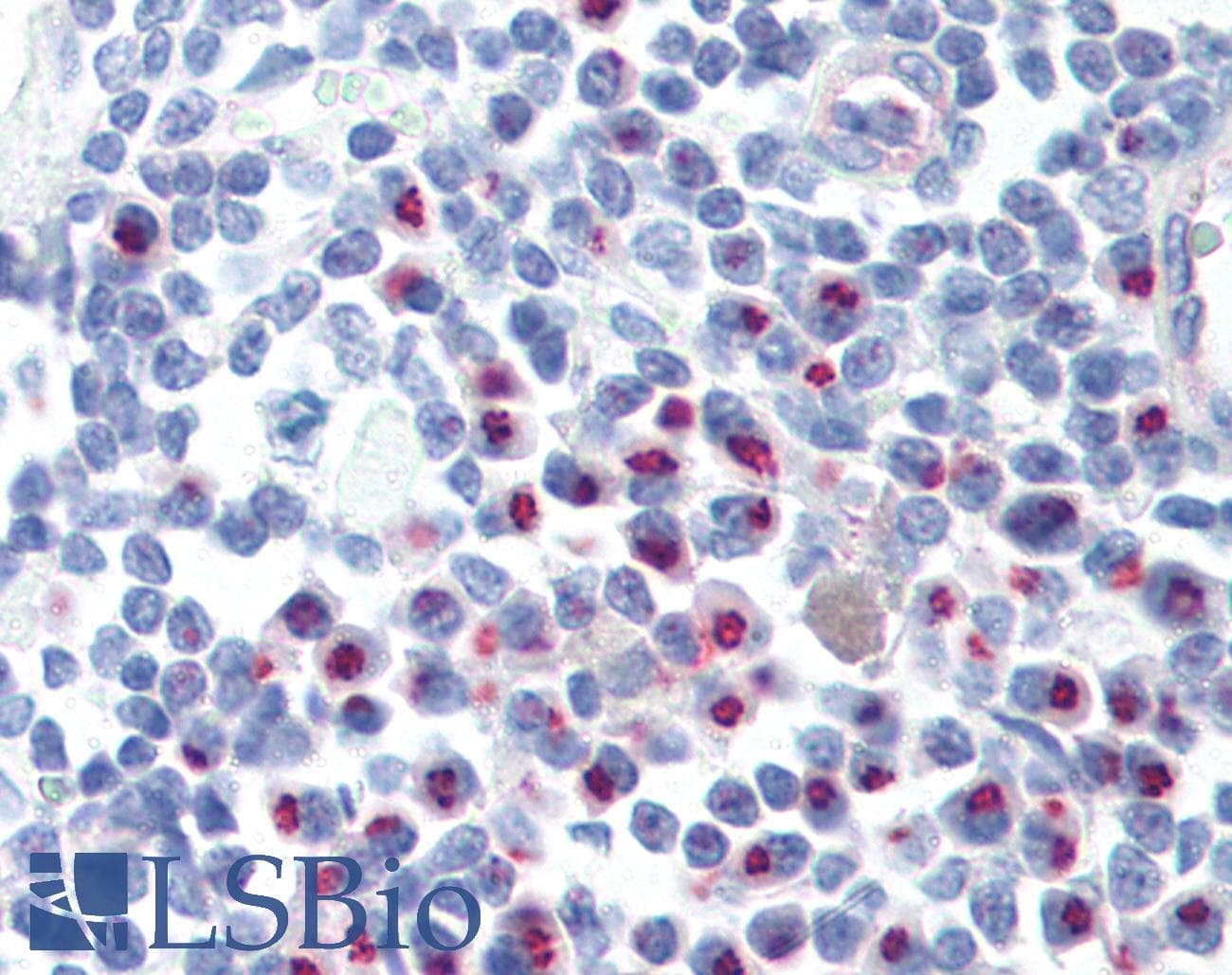 IHC-plus™ CCR4 Antibody (N-Terminus)