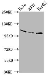 AASS / LKR / SDH Antibody