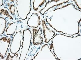 BDH2 Antibody (clone OTI2G1)